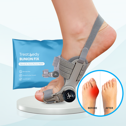 Treatmedy - Bunion Korrektor